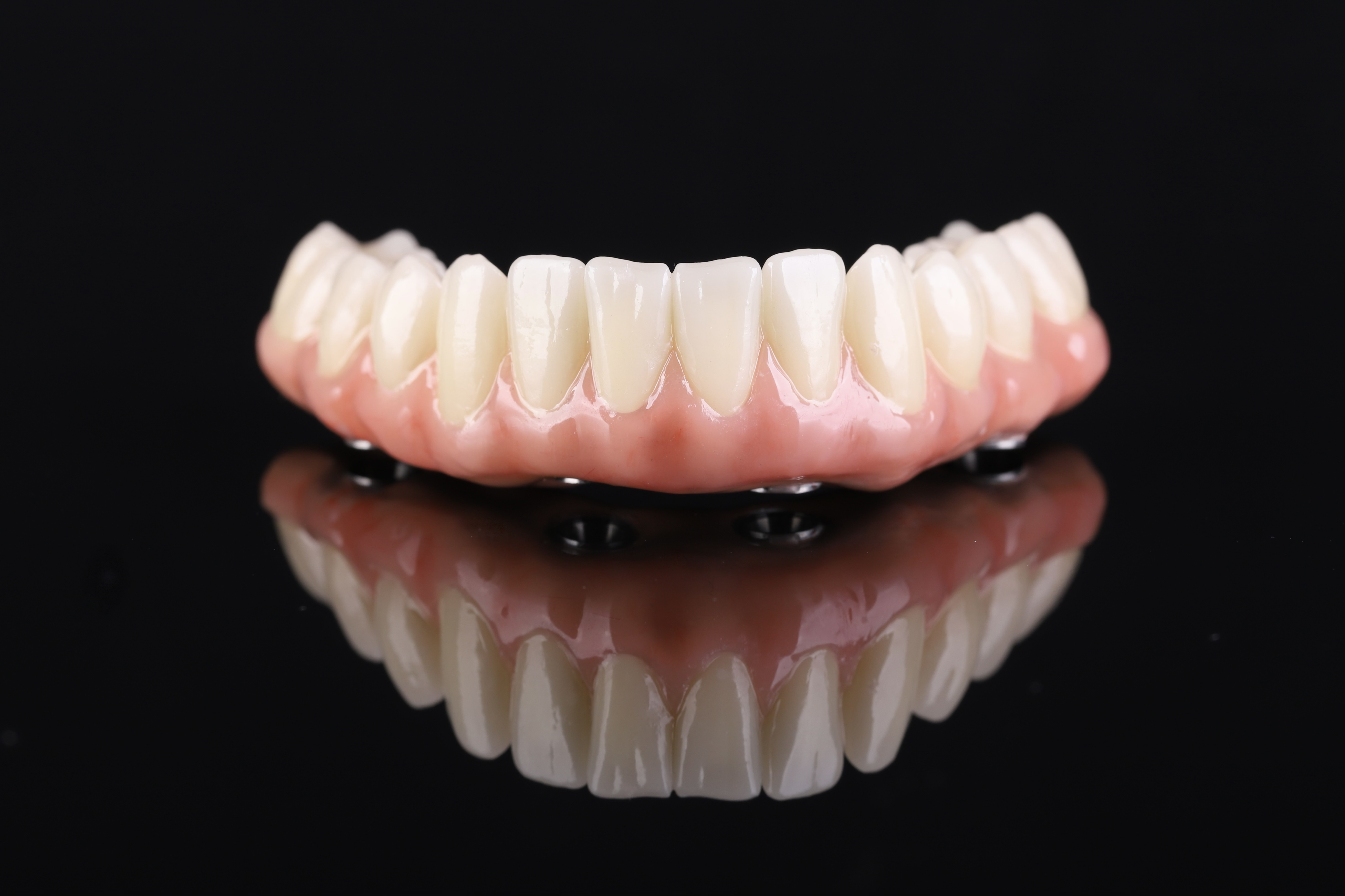 Dental restoration — Epic Dental Creations portfolio