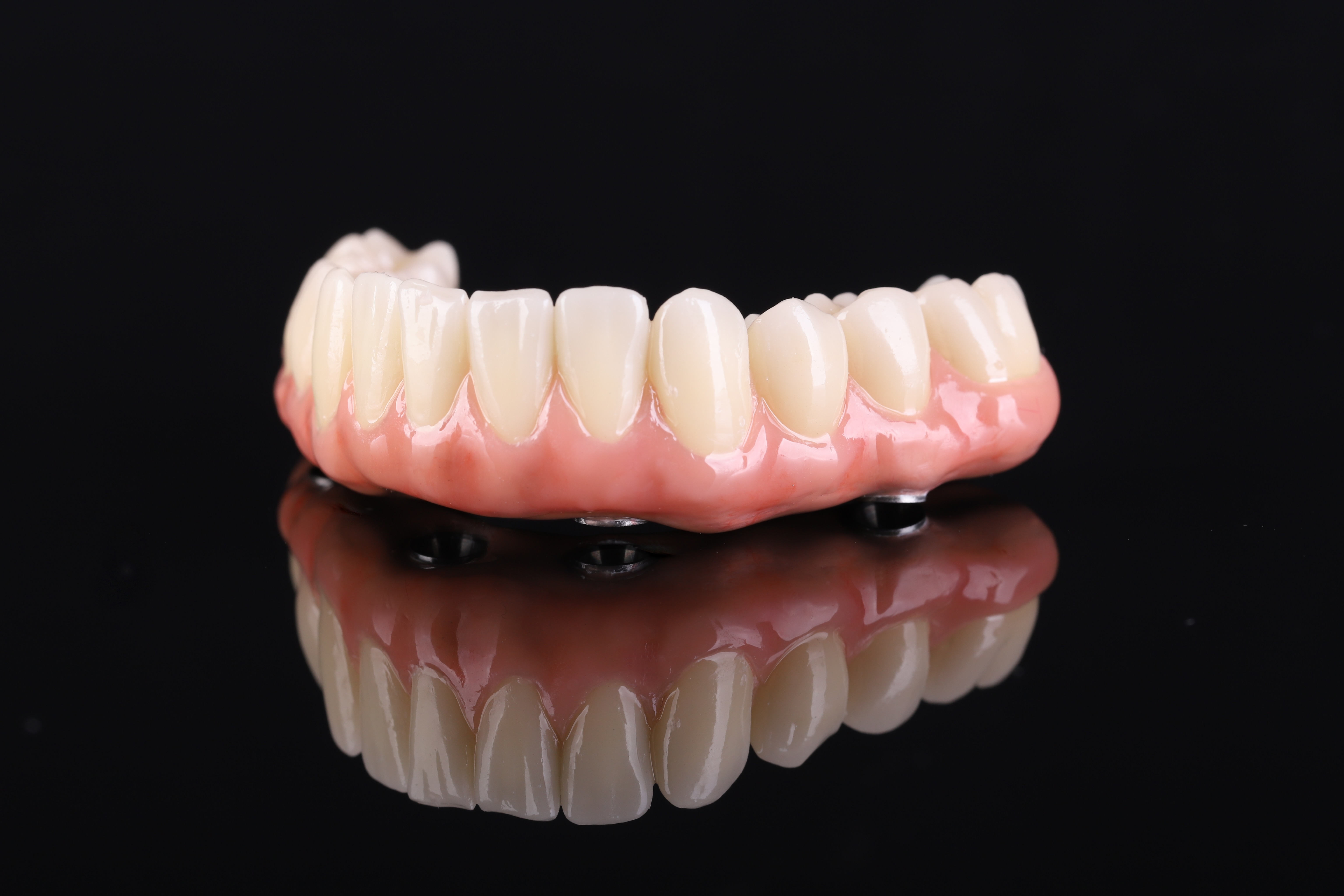 Dental restoration — Epic Dental Creations portfolio