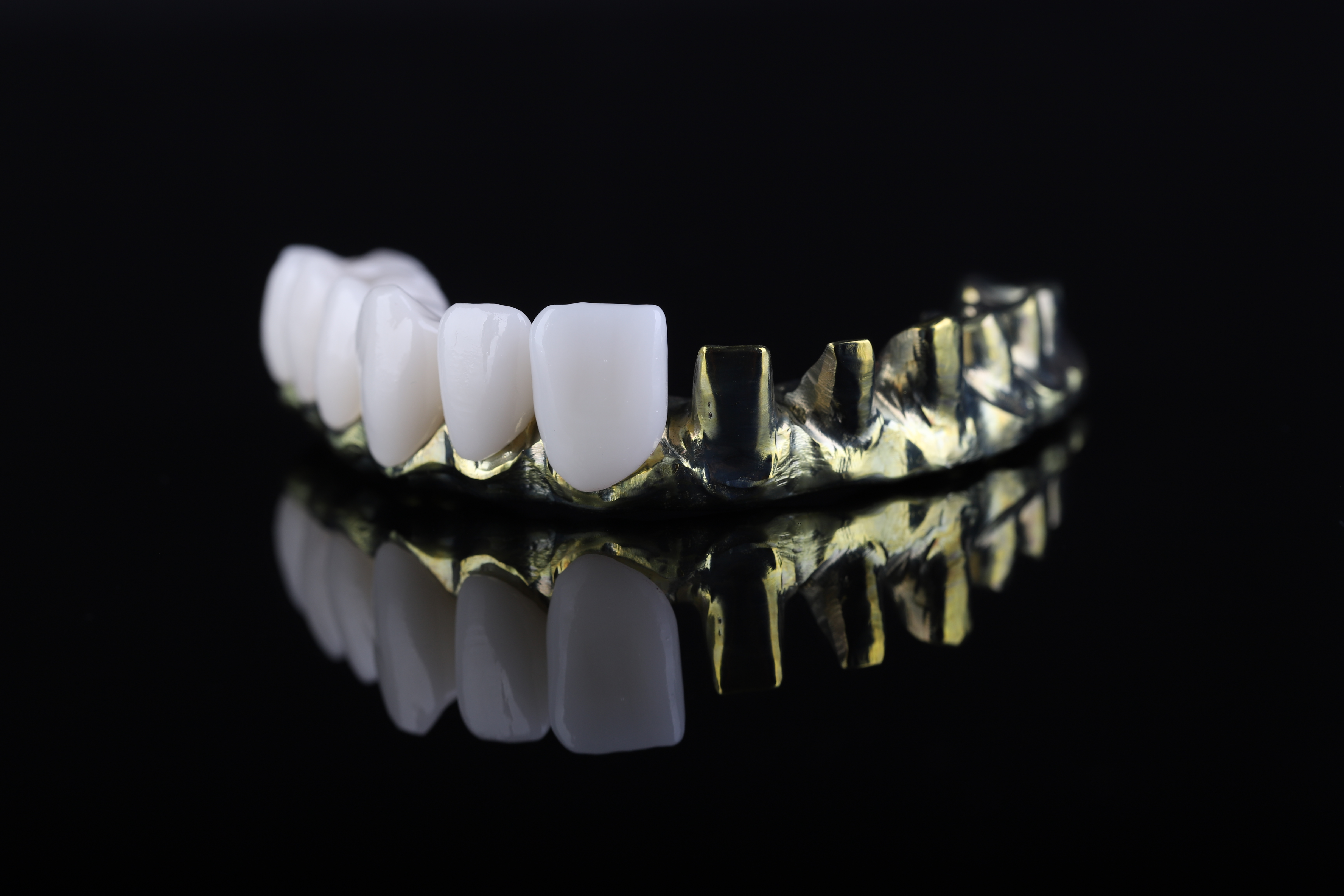 Dental restoration — Epic Dental Creations portfolio