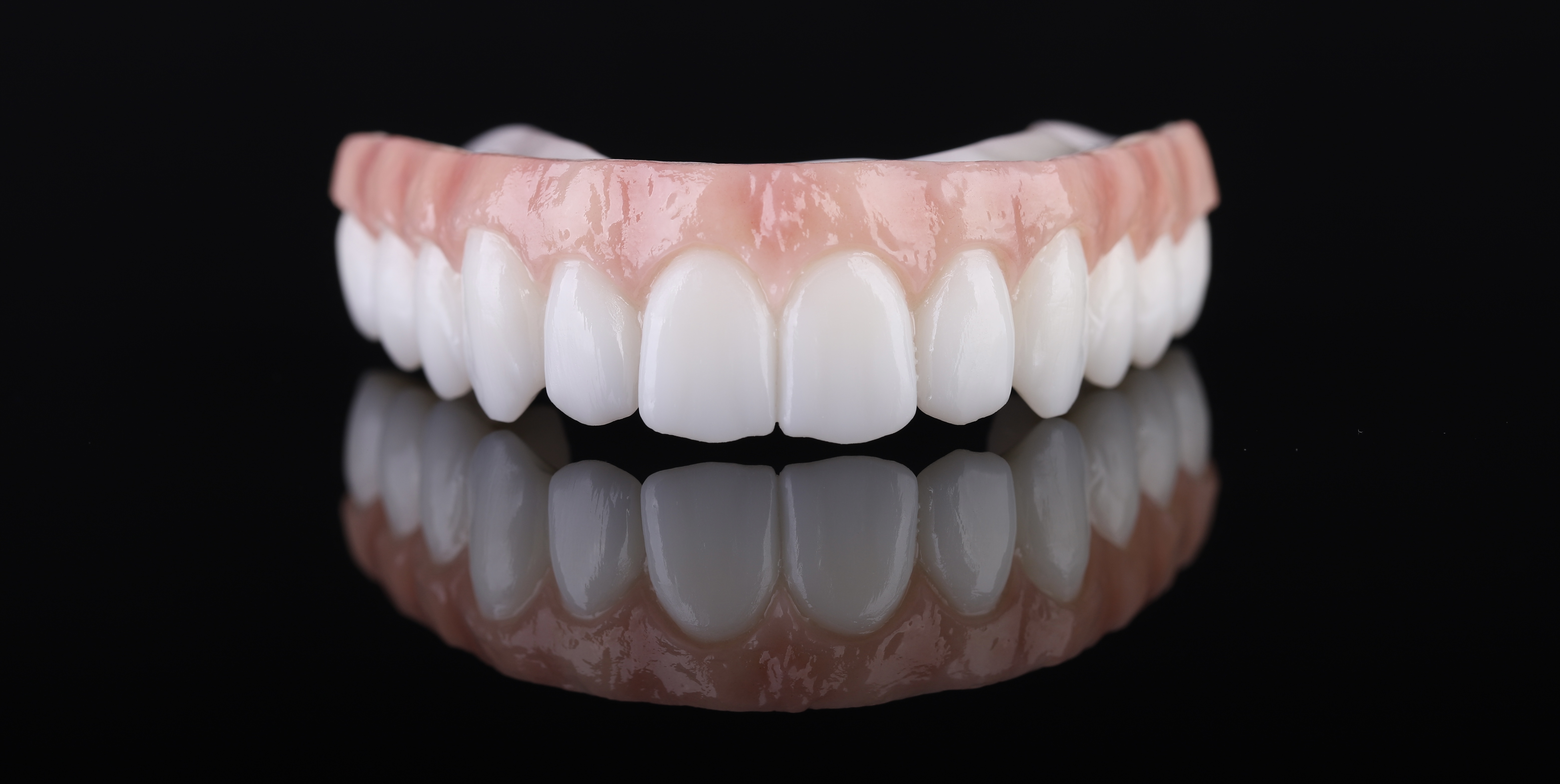 Dental restoration — Epic Dental Creations portfolio