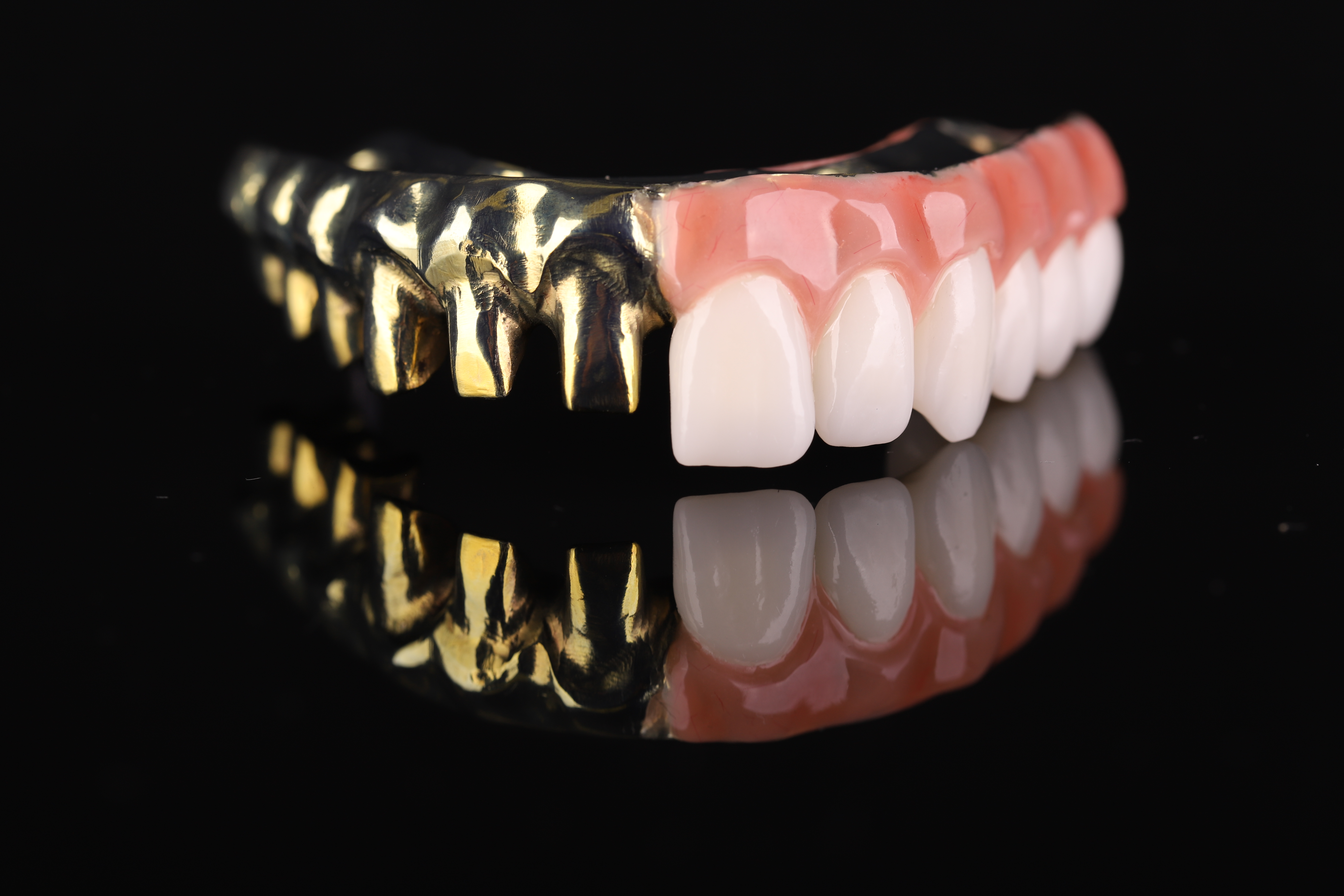 Two-part hybrid with titanium structure and zirconia crowns
